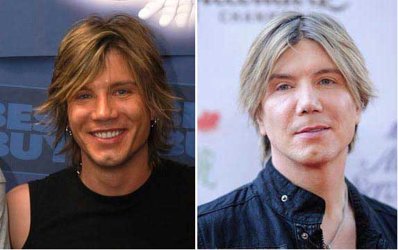 Johnny Rzeznik